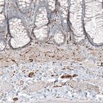 CD171 Antibody in Immunohistochemistry (Paraffin) (IHC (P))