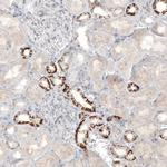 CD171 Antibody in Immunohistochemistry (Paraffin) (IHC (P))