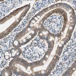 FBP1 Antibody in Immunohistochemistry (Paraffin) (IHC (P))