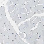 FBP1 Antibody in Immunohistochemistry (Paraffin) (IHC (P))