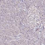 Ninein Antibody in Immunohistochemistry (Paraffin) (IHC (P))