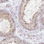 Ninein Antibody in Immunohistochemistry (Paraffin) (IHC (P))