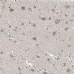 IkB epsilon Antibody in Immunohistochemistry (Paraffin) (IHC (P))