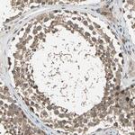 IkB epsilon Antibody in Immunohistochemistry (Paraffin) (IHC (P))