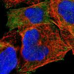 PARVA Antibody in Immunocytochemistry (ICC/IF)