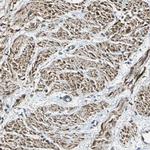 PARVA Antibody in Immunohistochemistry (Paraffin) (IHC (P))