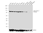 alpha Actinin 1 Antibody in Western Blot (WB)