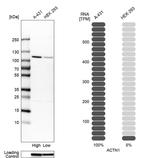 alpha Actinin 1 Antibody