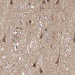 TSG101 Antibody in Immunohistochemistry (Paraffin) (IHC (P))