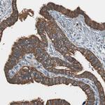 TSG101 Antibody in Immunohistochemistry (Paraffin) (IHC (P))