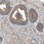 TSG101 Antibody in Immunohistochemistry (Paraffin) (IHC (P))