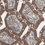 TSG101 Antibody in Immunohistochemistry (Paraffin) (IHC (P))