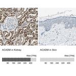 ACADM Antibody