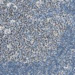 ACADM Antibody in Immunohistochemistry (Paraffin) (IHC (P))