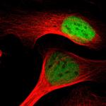 MTA2 Antibody in Immunocytochemistry (ICC/IF)