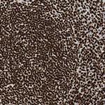 MTA2 Antibody in Immunohistochemistry (Paraffin) (IHC (P))