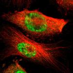 MED4 Antibody in Immunocytochemistry (ICC/IF)