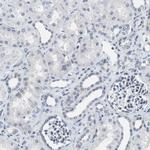 TCP1 Antibody in Immunohistochemistry (Paraffin) (IHC (P))