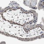 TCP1 Antibody in Immunohistochemistry (Paraffin) (IHC (P))