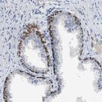 TCP1 Antibody in Immunohistochemistry (Paraffin) (IHC (P))