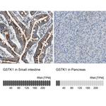 GSTK1 Antibody