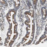 GSTK1 Antibody in Immunohistochemistry (Paraffin) (IHC (P))