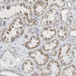 GSTK1 Antibody in Immunohistochemistry (Paraffin) (IHC (P))