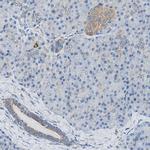 GSTK1 Antibody in Immunohistochemistry (Paraffin) (IHC (P))