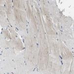 GSTK1 Antibody in Immunohistochemistry (Paraffin) (IHC (P))