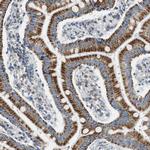 GSTK1 Antibody in Immunohistochemistry (Paraffin) (IHC (P))