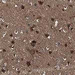 HPRT1 Antibody in Immunohistochemistry (Paraffin) (IHC (P))