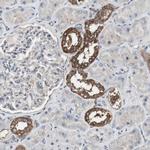 HPRT1 Antibody in Immunohistochemistry (Paraffin) (IHC (P))