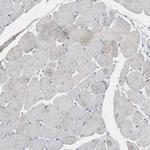 HPRT1 Antibody in Immunohistochemistry (Paraffin) (IHC (P))