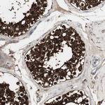 HPRT1 Antibody in Immunohistochemistry (Paraffin) (IHC (P))