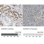 ALDH4A1 Antibody