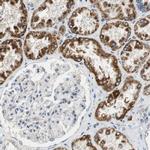 ALDH4A1 Antibody in Immunohistochemistry (Paraffin) (IHC (P))