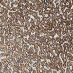 ALDH4A1 Antibody in Immunohistochemistry (Paraffin) (IHC (P))