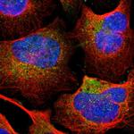 TIP30 Antibody in Immunocytochemistry (ICC/IF)