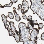 TIP30 Antibody in Immunohistochemistry (Paraffin) (IHC (P))