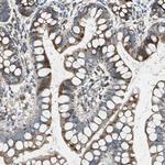 TIP30 Antibody in Immunohistochemistry (Paraffin) (IHC (P))