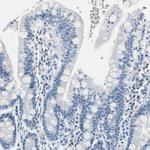 Carbonic Anhydrase I Antibody in Immunohistochemistry (Paraffin) (IHC (P))