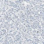 Carbonic Anhydrase I Antibody in Immunohistochemistry (Paraffin) (IHC (P))