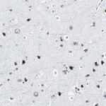 XRCC1 Antibody in Immunohistochemistry (Paraffin) (IHC (P))