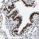 XRCC1 Antibody in Immunohistochemistry (Paraffin) (IHC (P))