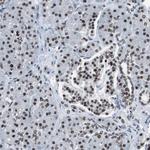 XRCC1 Antibody in Immunohistochemistry (Paraffin) (IHC (P))