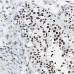 XRCC1 Antibody in Immunohistochemistry (Paraffin) (IHC (P))