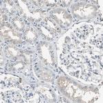 FEN1 Antibody in Immunohistochemistry (Paraffin) (IHC (P))