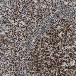 FEN1 Antibody in Immunohistochemistry (Paraffin) (IHC (P))