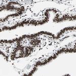 PNK Antibody in Immunohistochemistry (Paraffin) (IHC (P))