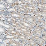 Nestin Antibody in Immunohistochemistry (Paraffin) (IHC (P))